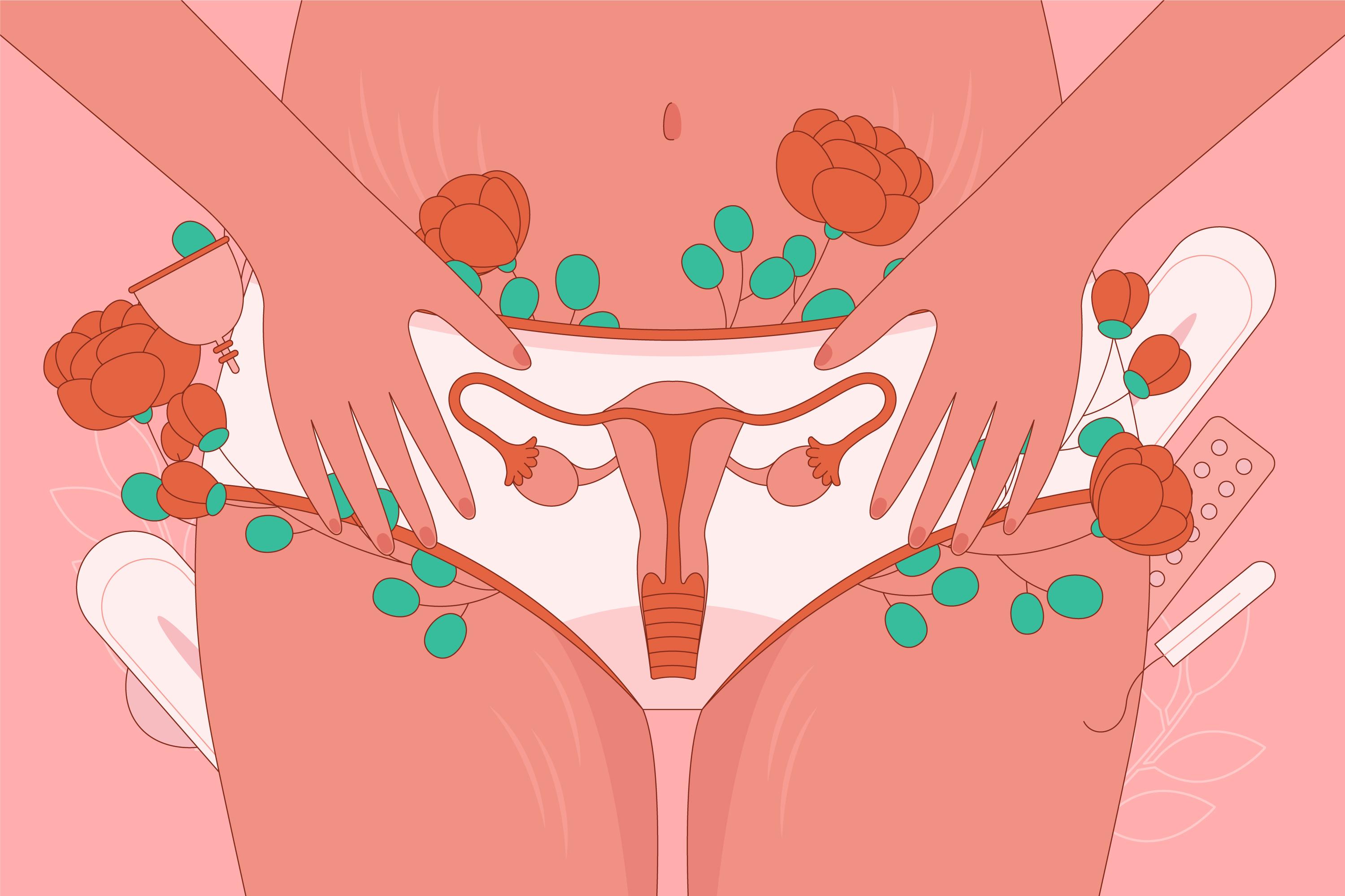 Apa itu Endometriosis? - Medikacare
