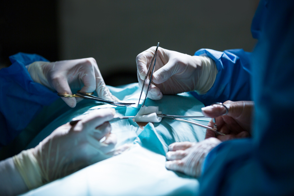 4 Penyebab nyeri dibekas luka operasi - Medikacare