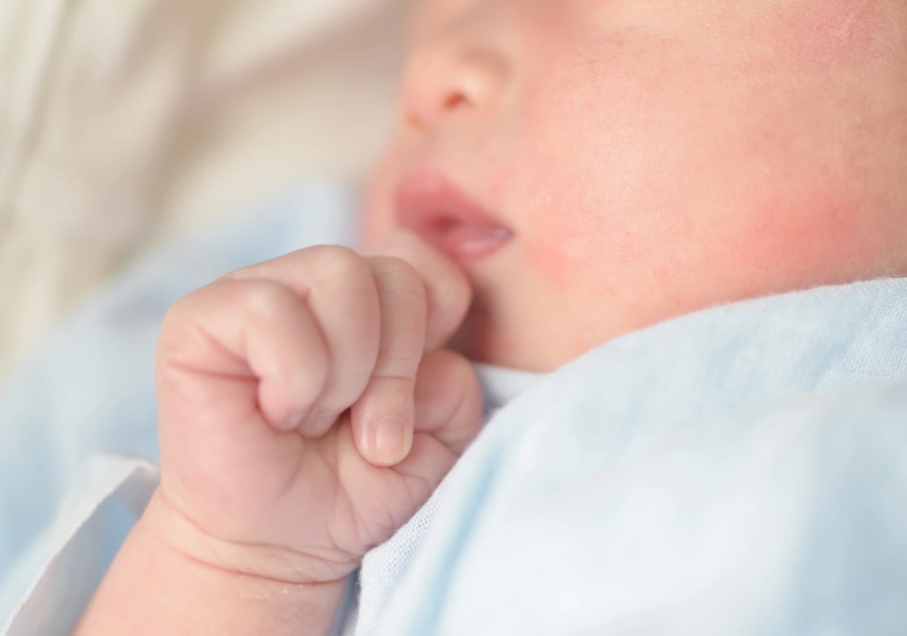5 Penyebab Pipi merah pada bayi - Medikacare