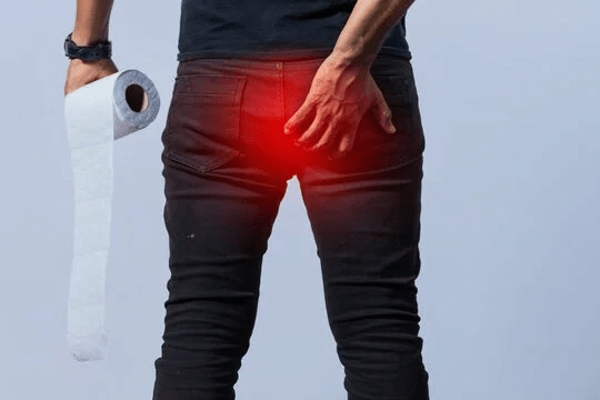 5 Pilihan Obat Ambeien yang Ampuh untuk Redakan Bengkak dan Nyeri