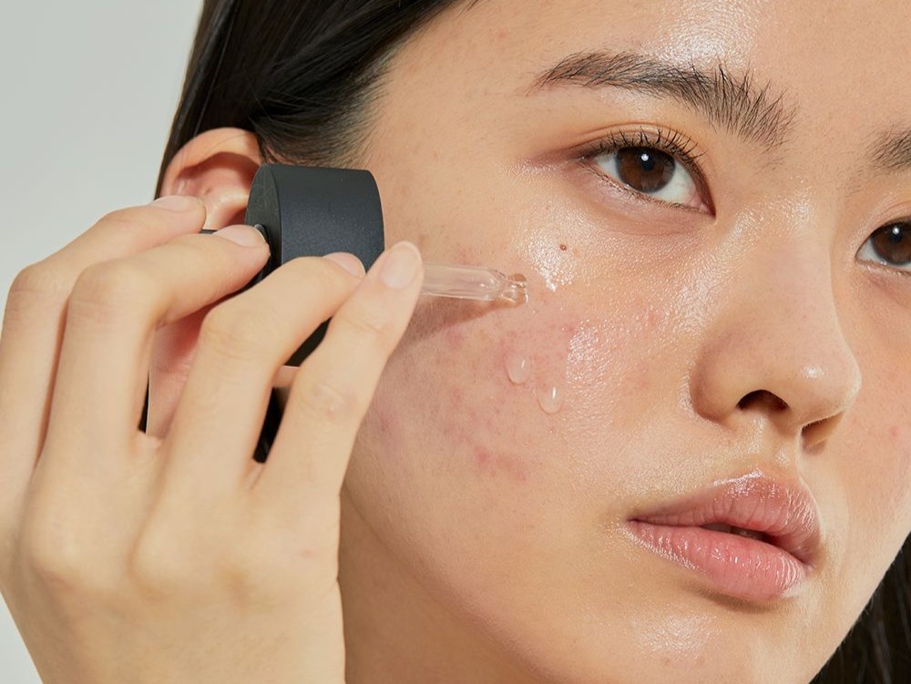 5 Rekomendasi Serum Jerawat di Bawah 100 Ribu, Cocok untuk Acne Prone