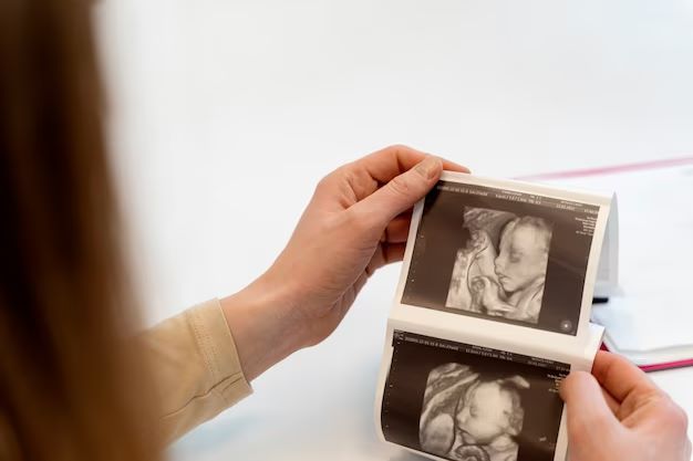 Beberapa Gangguan Plasenta Bayi - Medikacare