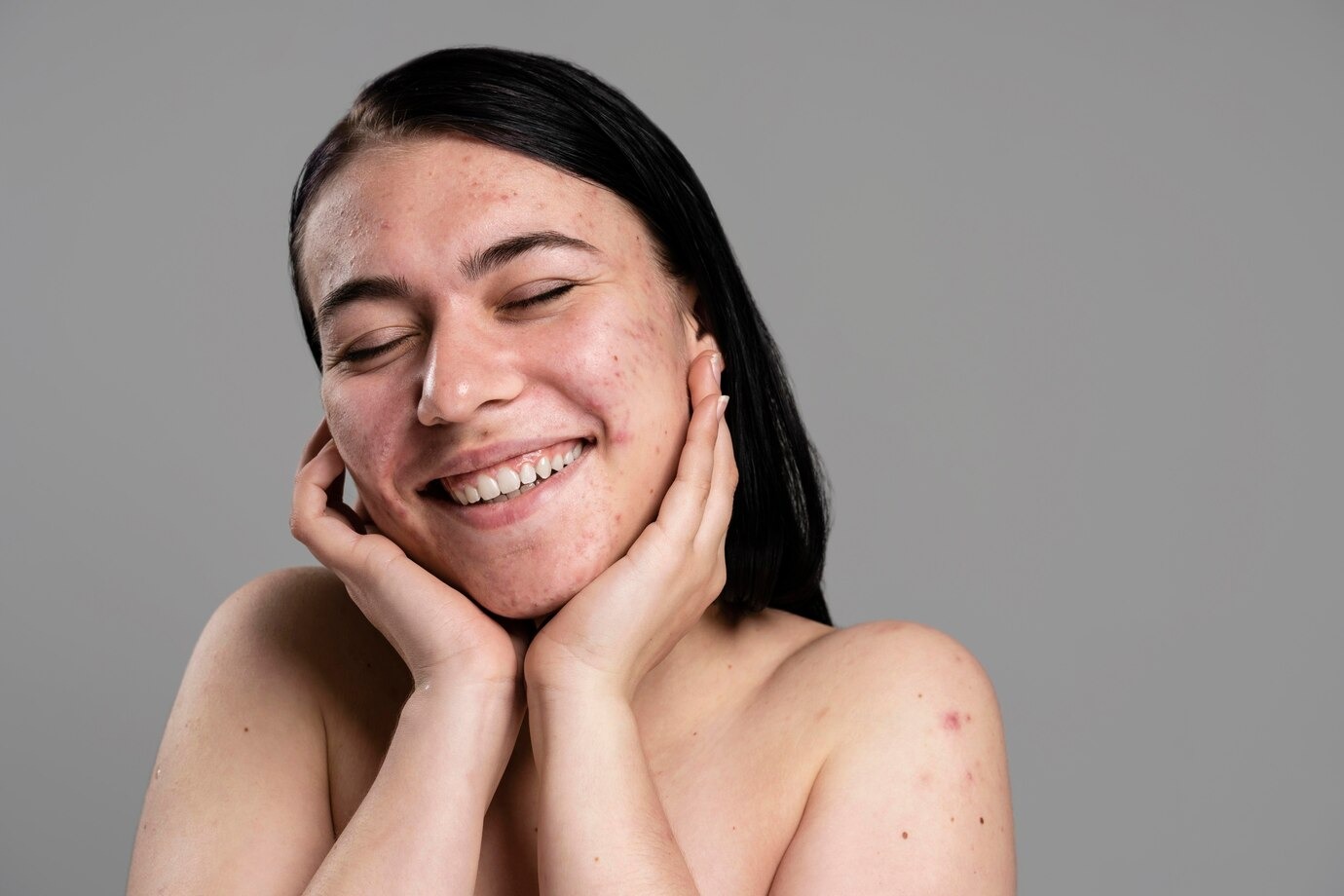 Cara Mudah Mengatasi Kulit Kusam - Medikacare