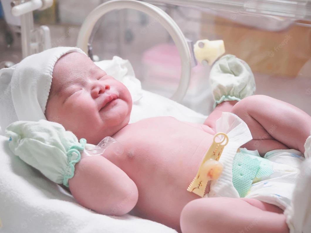 Kenali cara merawat bayi prematur - Medikacare