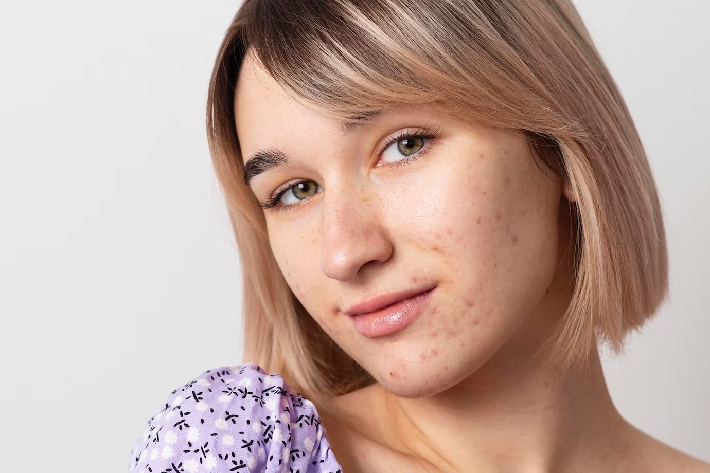 Maksud dari kulit Normal to Oily - Medikacare