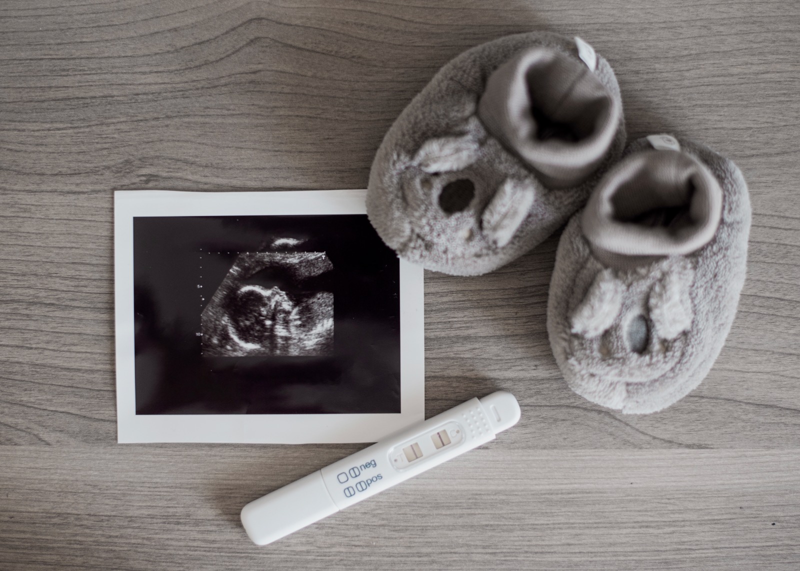 Mendeteksi Jenis Kelamin Bayi tanpa USG - Medikacare