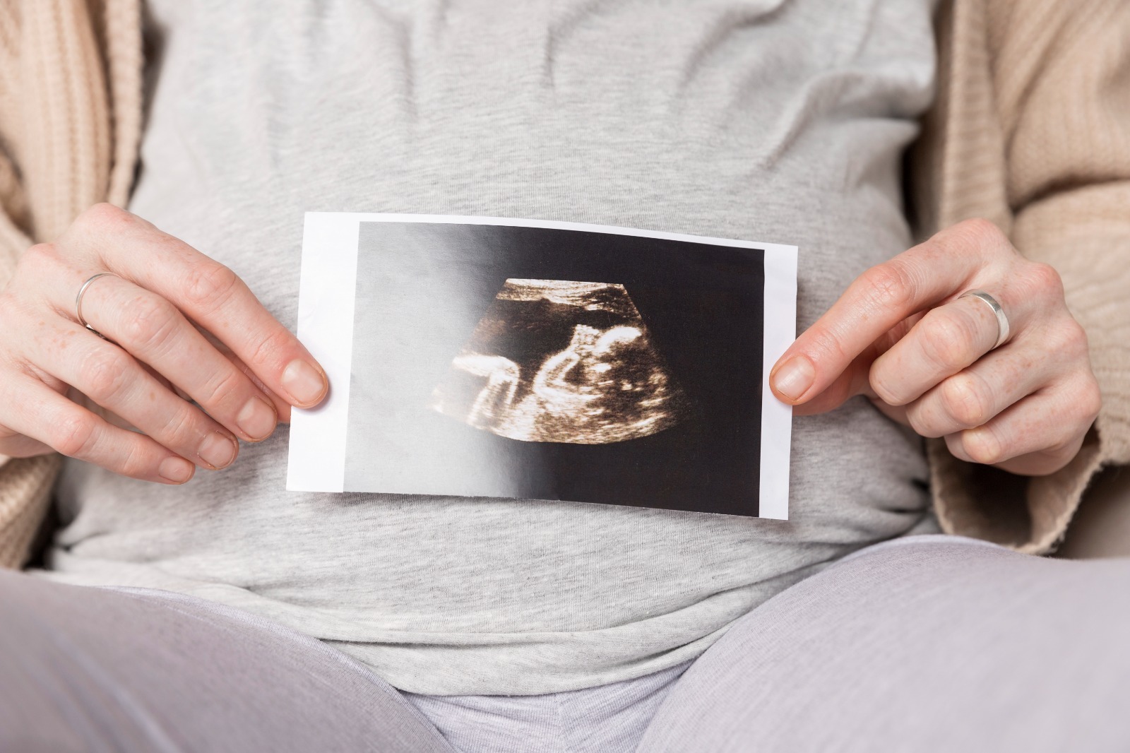 Normalkah Bayi dalam Kandungan Cegukan? - Medikacare