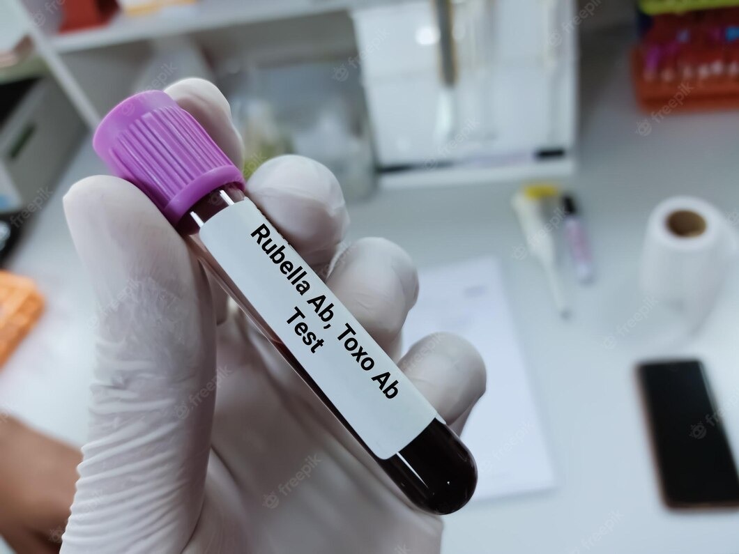 Pemeriksaan Toxoplasma untuk ibu hamil - Medikacare