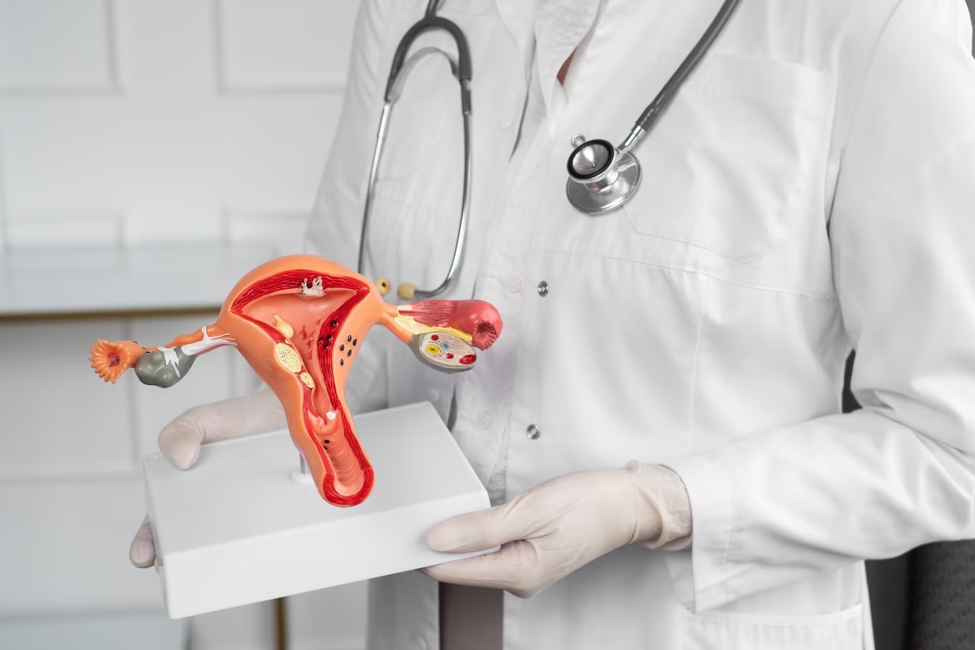 Tips diet untuk penderita PCOS - Medikacare