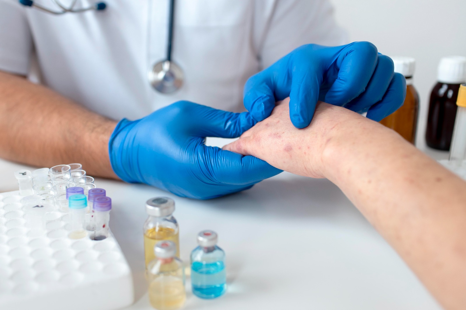 Waspadai Ciri-Ciri HIV pada Kulit - Medikacare