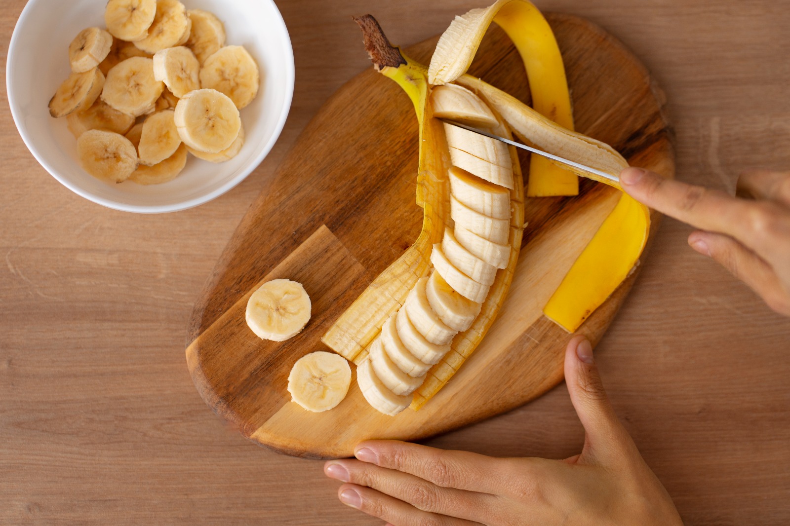 Apakah Benar Pisang Goreng Dapat Menjadi Obat Asam Lambung? - Medikacare