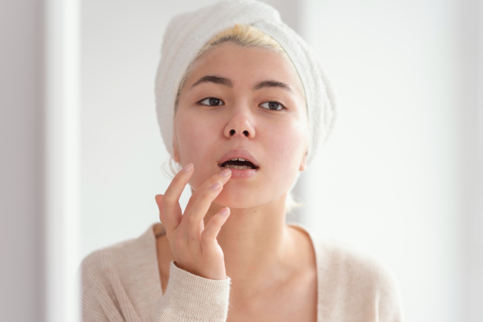 Tips Mencegah Bibir Kering - Medikacare