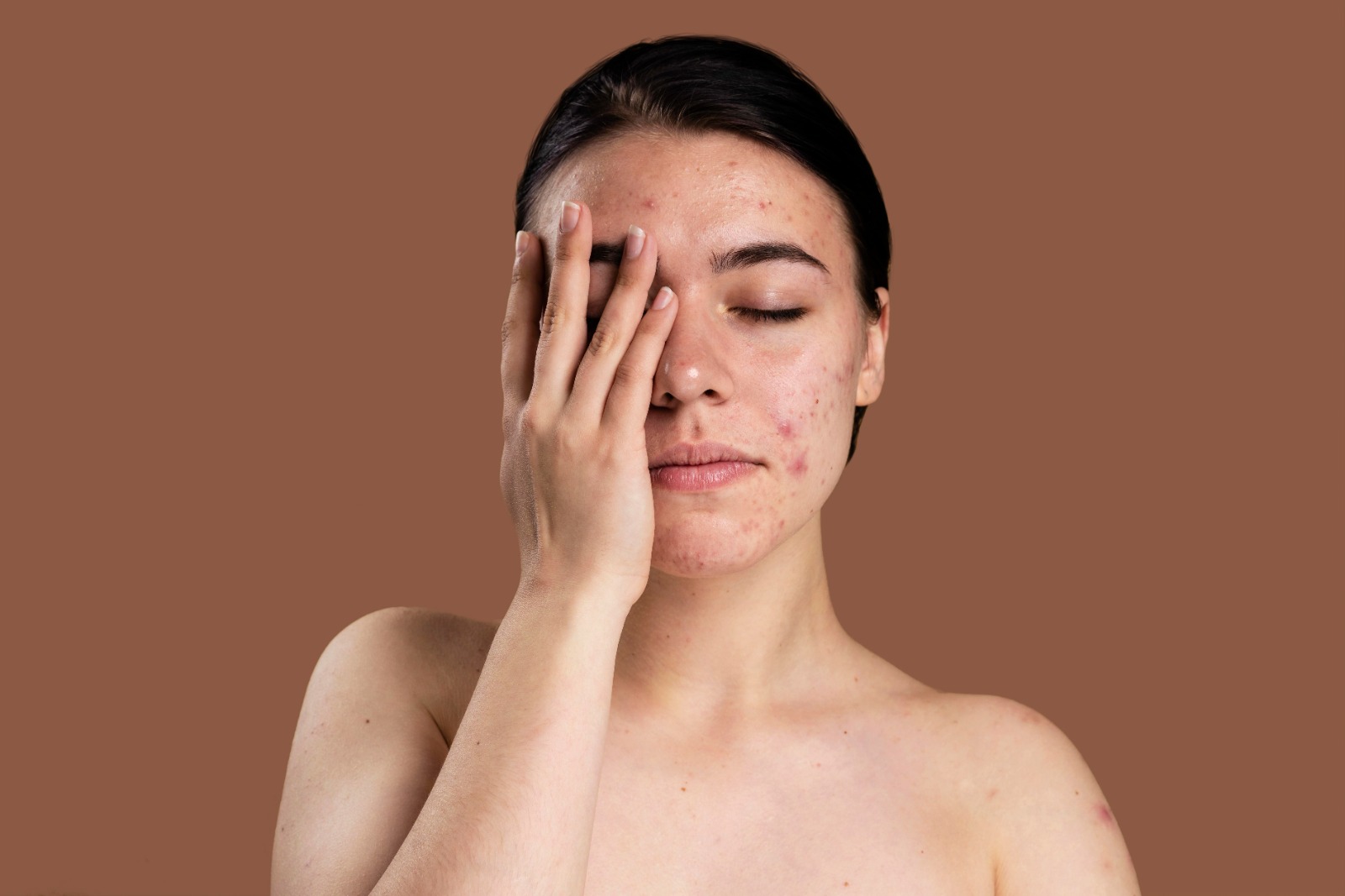 Efek Buruk Menggunakan Skincare Abal-Abal - Medikacare