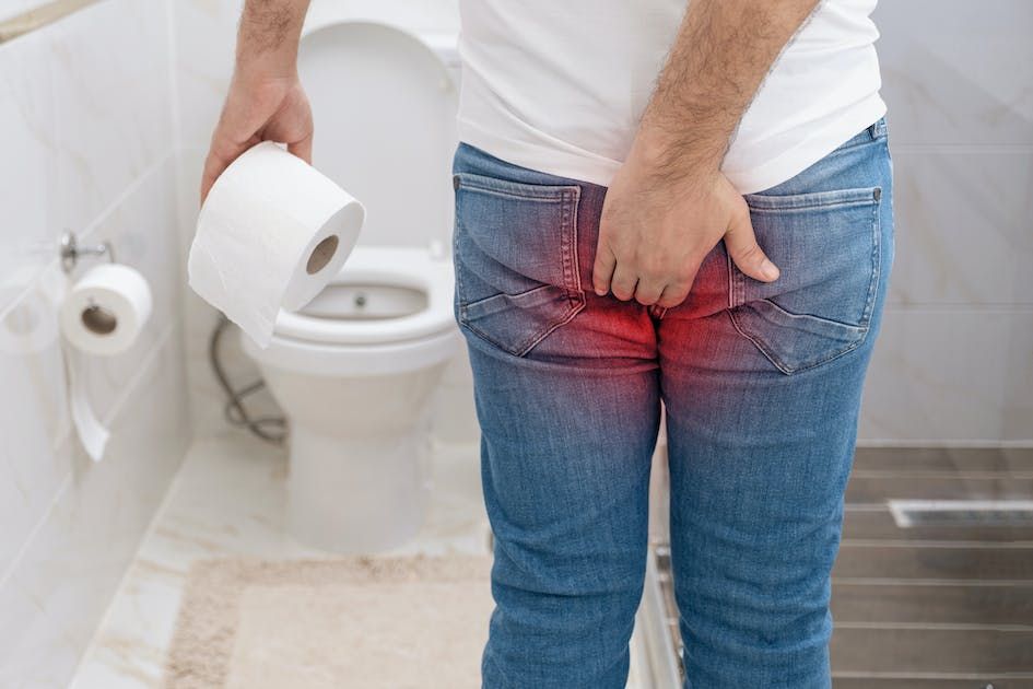 Jangan Abaikan! Ini Ciri-Ciri Wasir dan Ambeien, Cegah dengan Kapsul Herbal Alami
