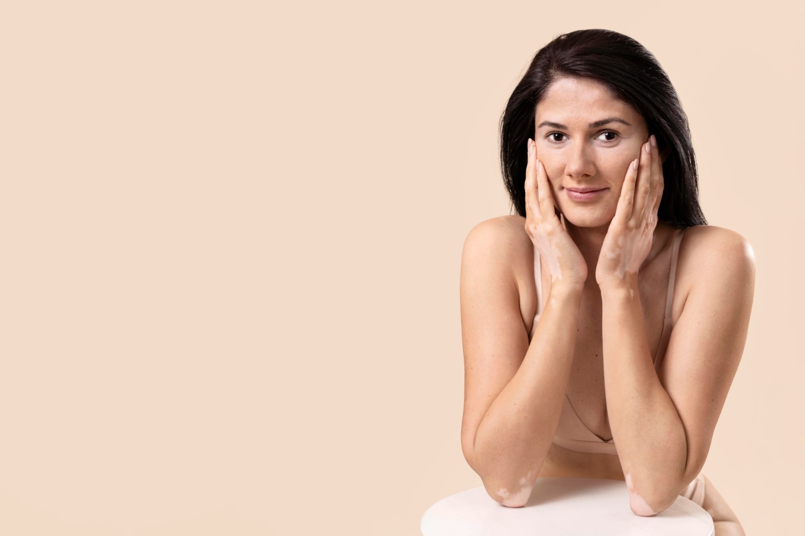 Vitiligo - Medikacare