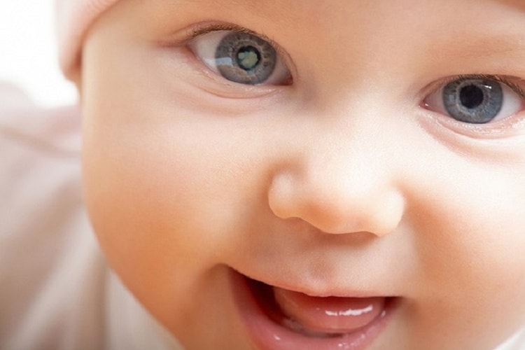 Kenali katarak pada bayi - Medikacare